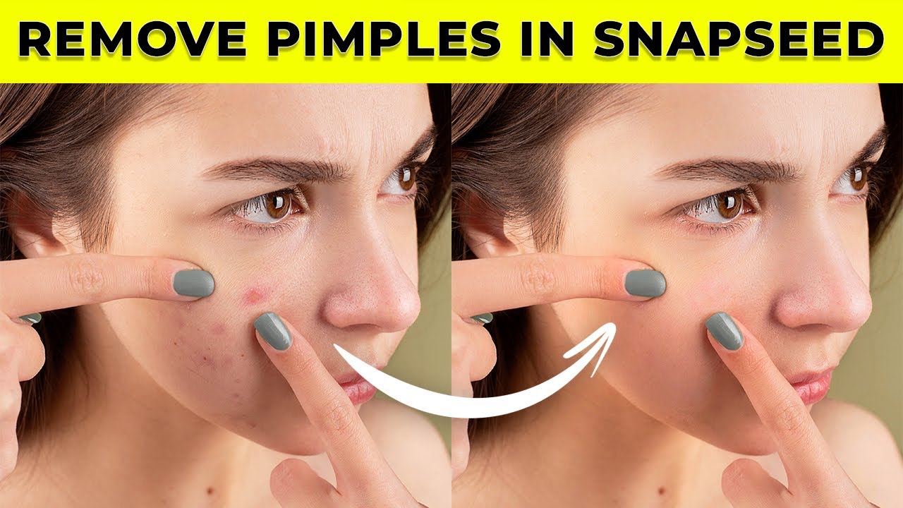 How to remove pimples in snapseed | face smooth editing | smooth skin | remove pimples | snapseed