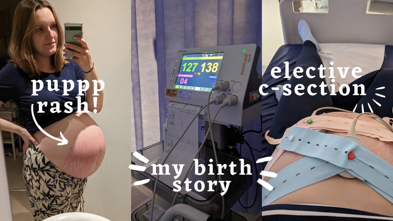 My Twin Birth Story | Born in 2023 | Twin Mum UK