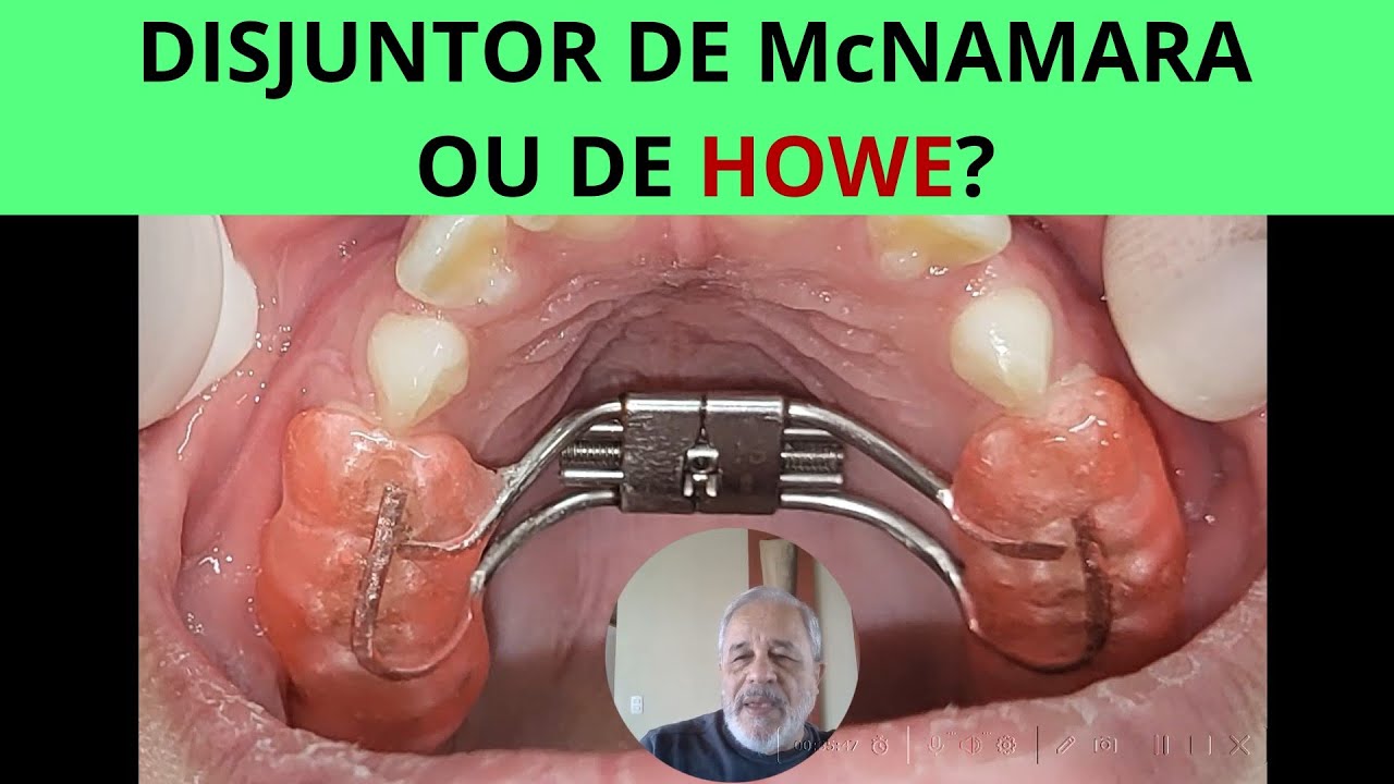 Disjuntor de McNamara ou de Howe?