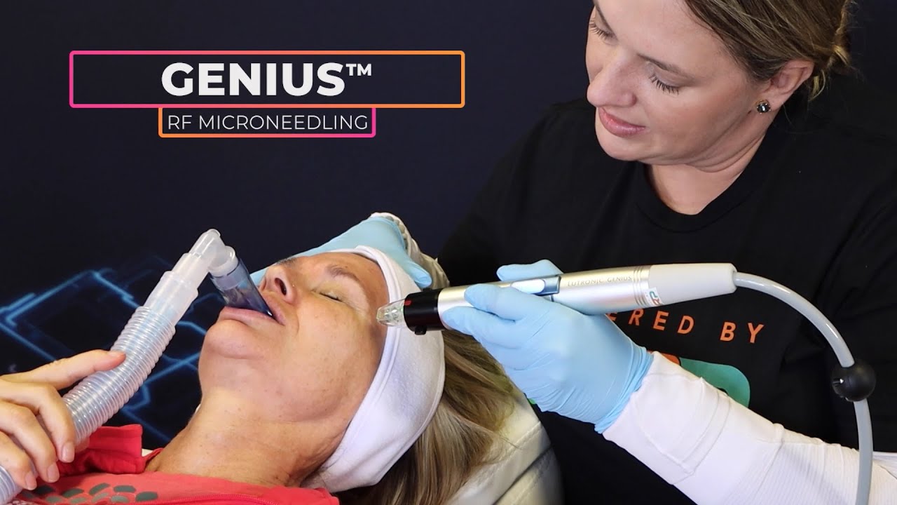Lutronic Genius RF Microneedling - Face treatment