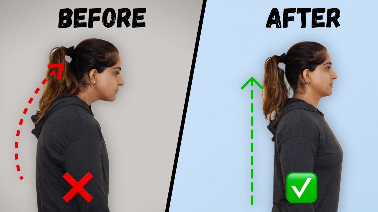 Fix Rounded Posture | Best Posture Correction Exercises | xHERciser