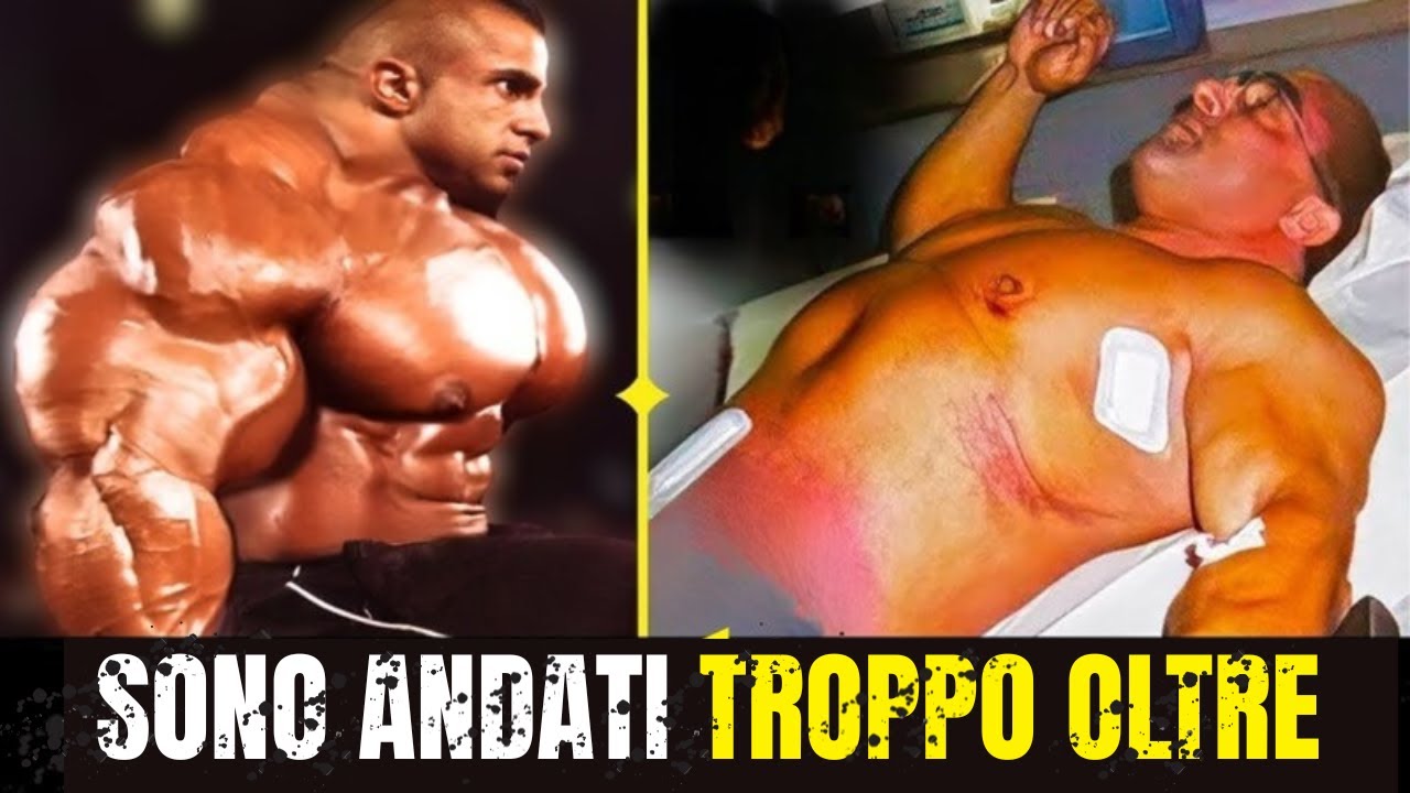 12 BODYBUILDER CHE HANNO SUPERATO I LIMITI DELLA LORO VITA