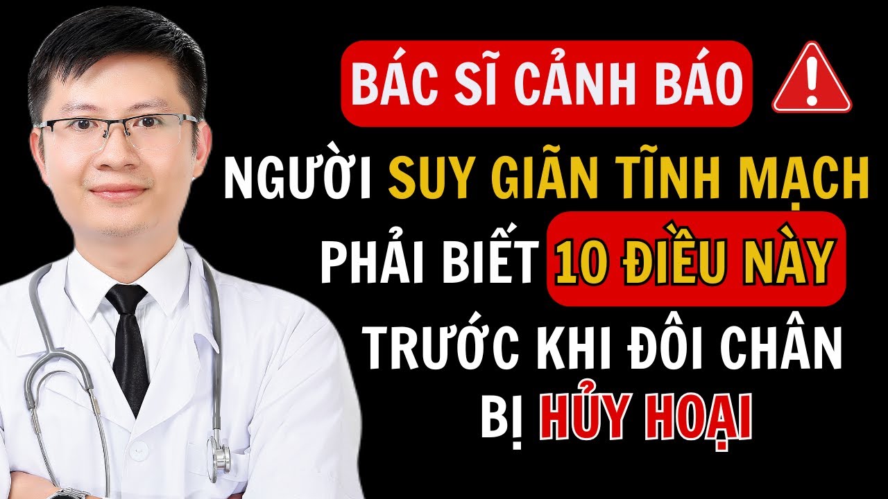 Người Bị Suy Giãn Tĩnh Mạch Phải Biết 10 Điều Trước Khi Đôi Chân Bị Hủy Hoại | Cao Minh Trường