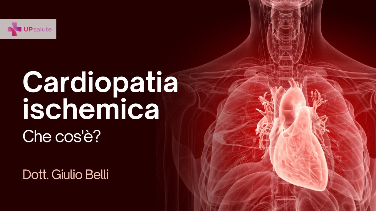 Che cos'è la cardiopatia ischemica? - Dott. Guido Belli - UPsalute Channel