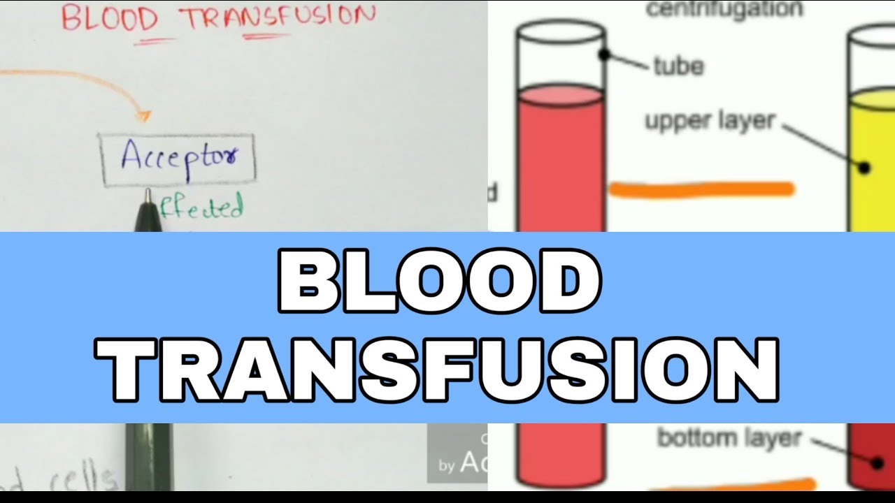 Blood transfusion | Types, mechanism, precautions and notes | Bio science