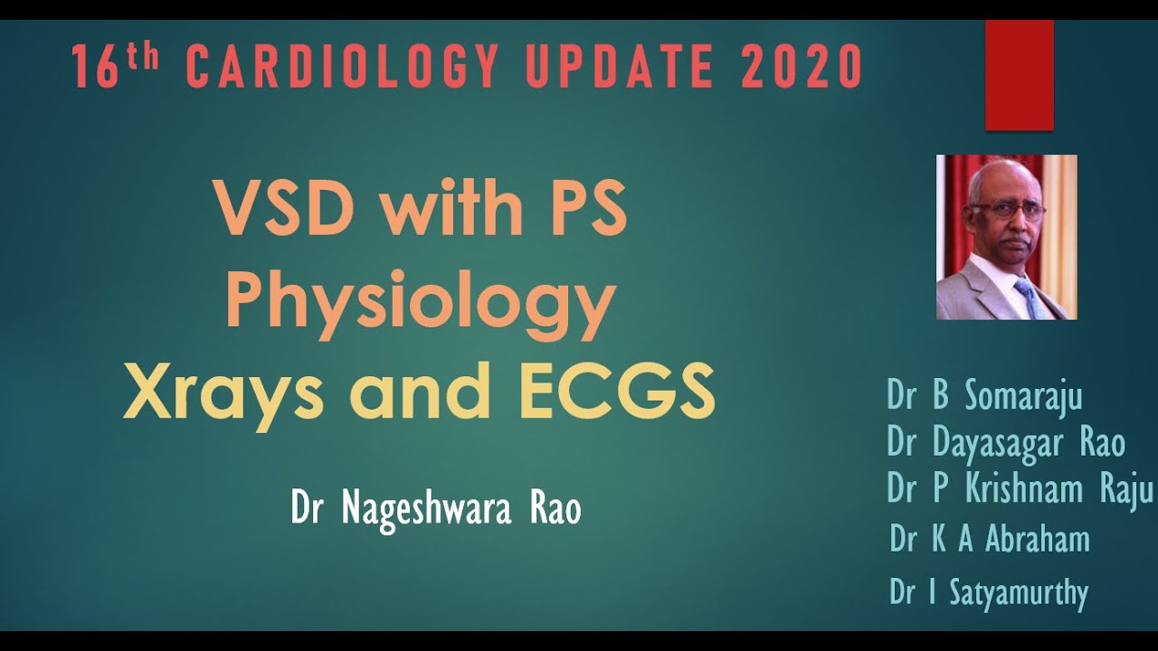 VSD with PS Physiology   Xrays and ECG  Dr Nageshwara Rao 16th Cardiology Update 2020