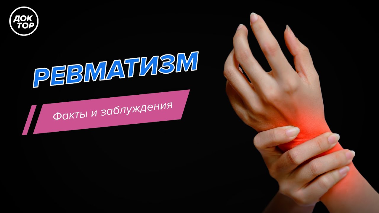 Ревматизм. Факты и заблуждения.