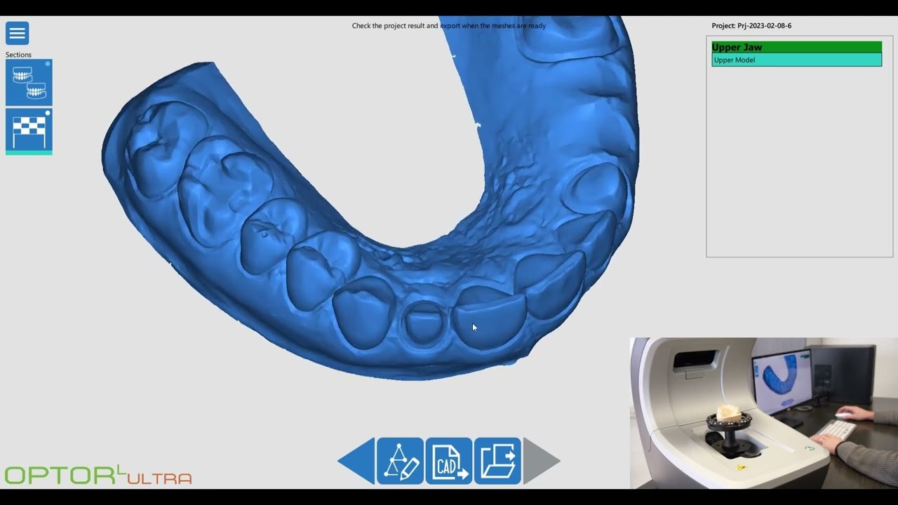 Innovazione Odontotecnica: Progetti con Optor Lab Scanner