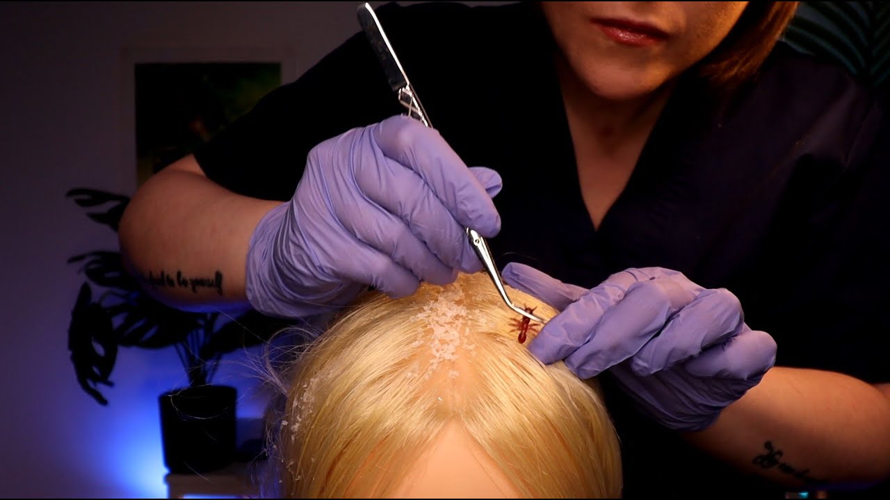ASMR Scalp Check, Lice Removal & Treatment: Satisfyingly GOOD!!