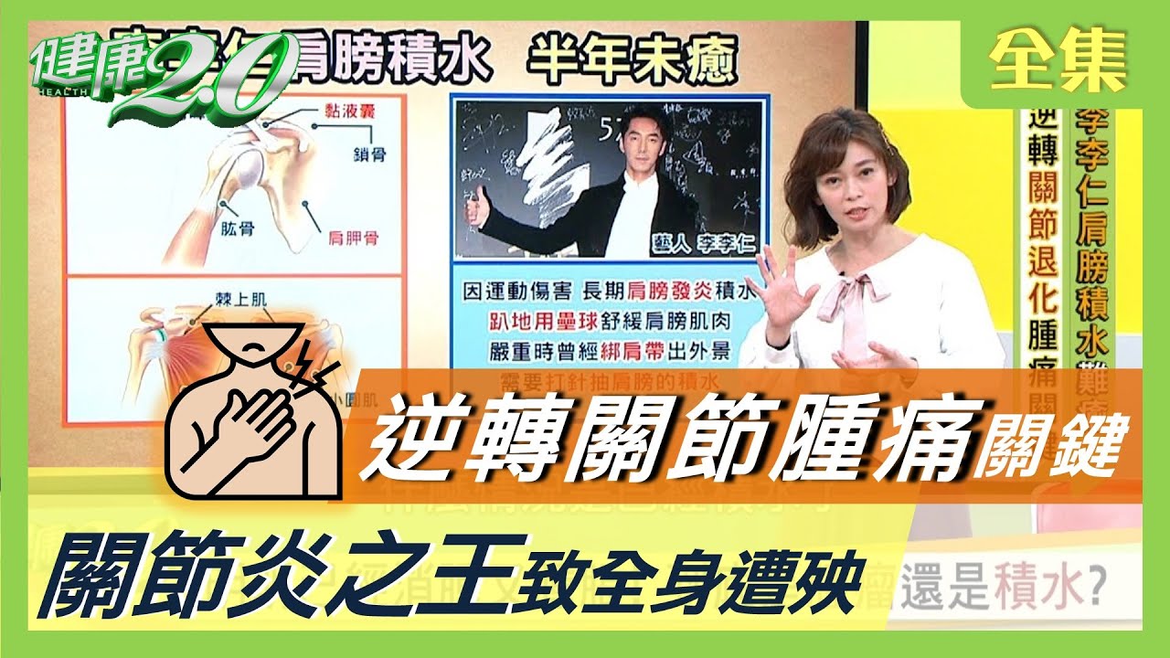 關節積水？肩膀痛？逆轉關節退化腫痛關鍵！ 小心 關節炎 致全身遭殃 健康2.0 20201206 (完整版)