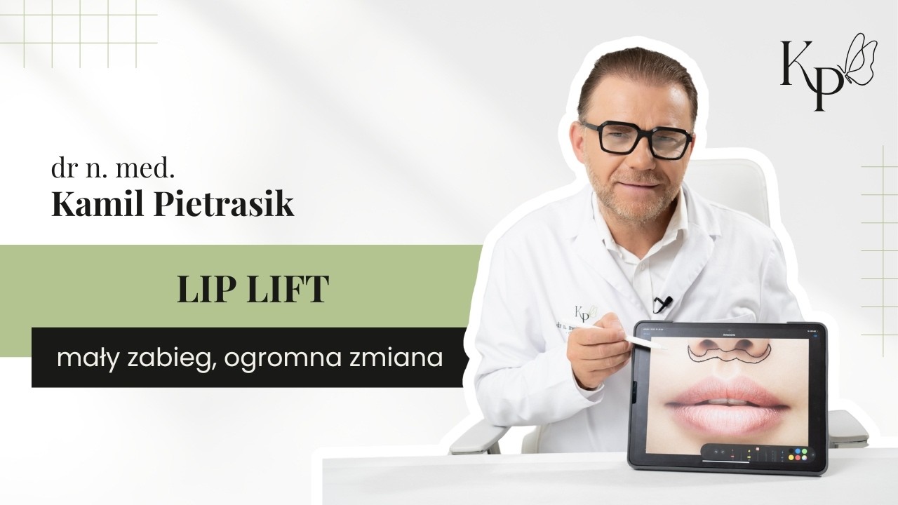 LIP LIFT - wszystko co Pacjentka powinna wiedzieć!
