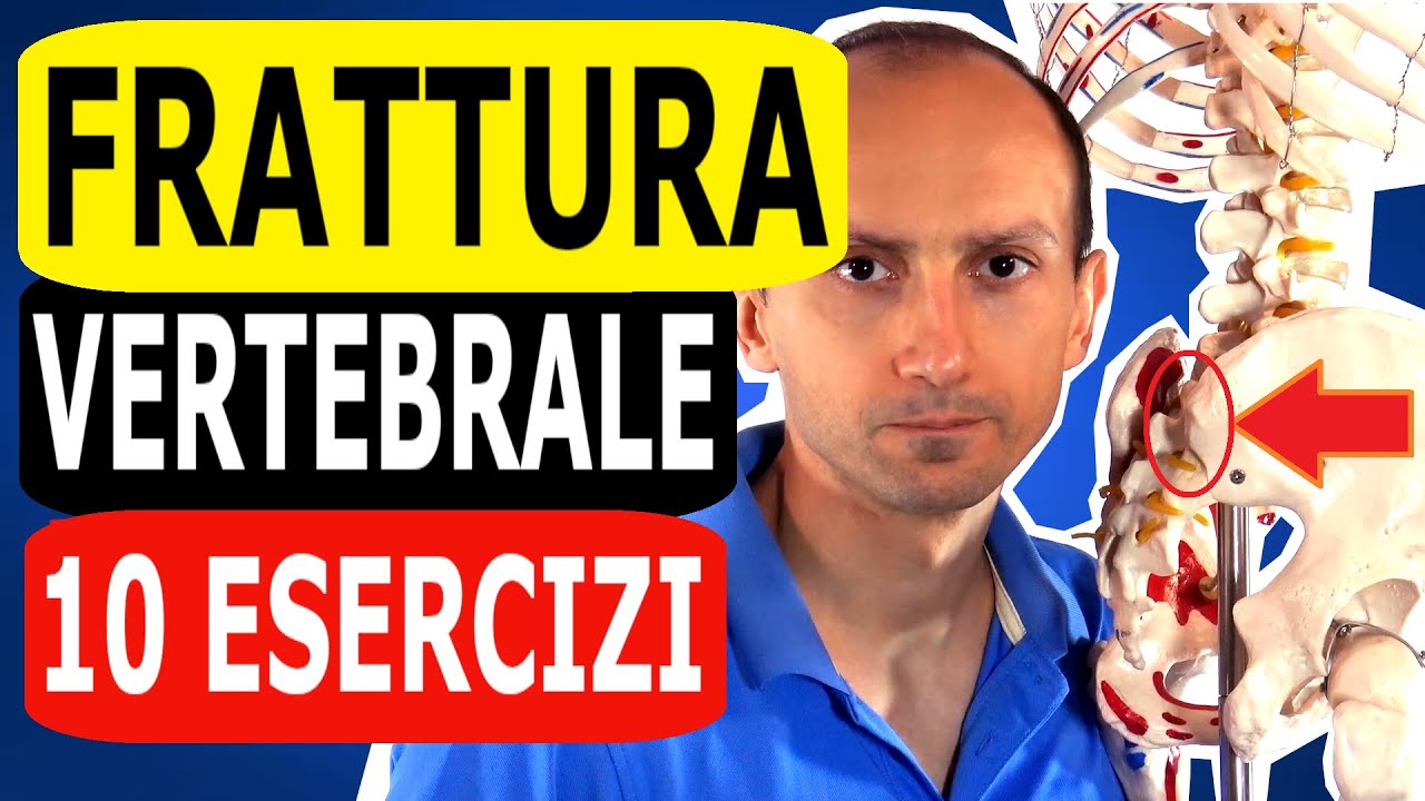 10 Esercizi di Riabilitazione per una Frattura Vertebrale
