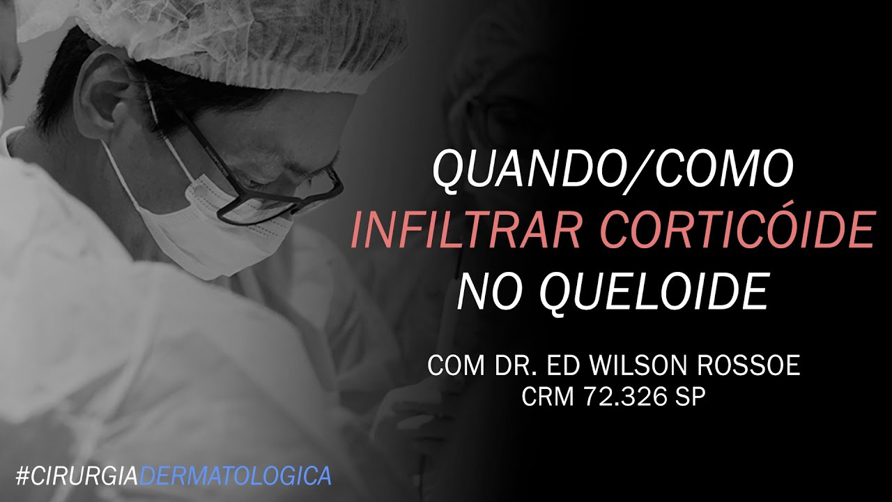 QUANDO/COMO INFILTRAR CORTICÓIDE NO QUELOIDE | DR ED WILSON ROSSOE | CIRURGIA DERMATOLÓGICA