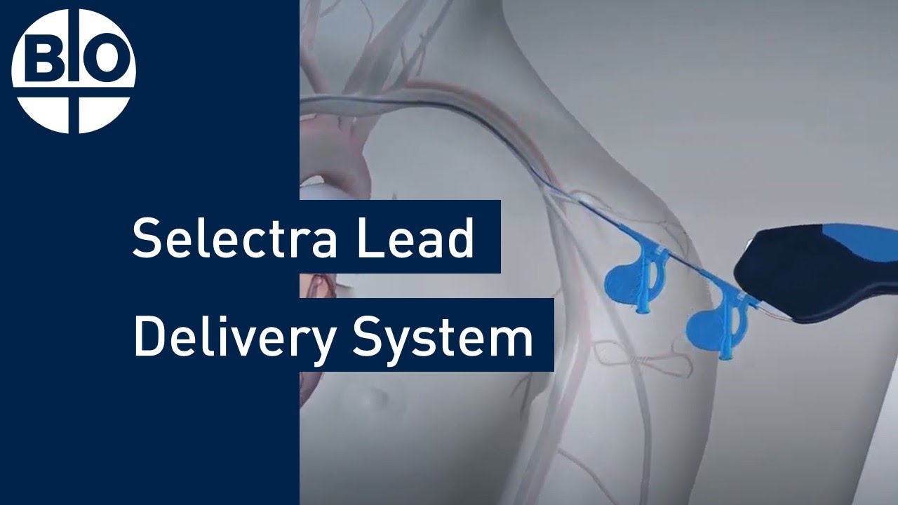Enhancing CRT with Selectra Lead Delivery System