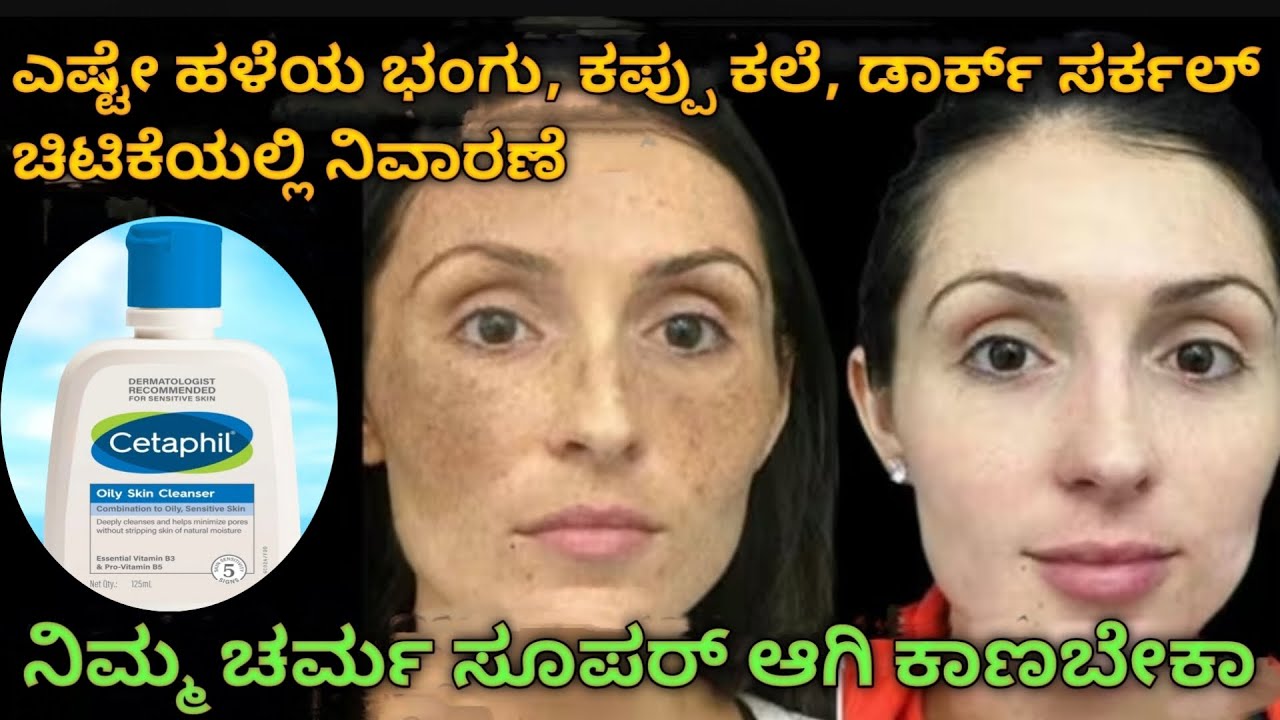 Cetaphil gentle skin cleanser | skin care tips in kannada #skinglowingtips#cetaphilcleanser#kannada