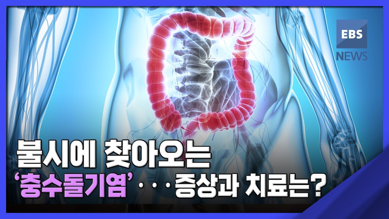 2022. 08. 09. [뉴스브릿지] 불시에 찾아오는 '충수돌기염'···증상과 치료는?