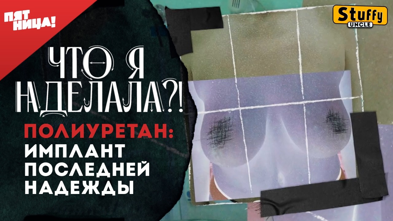 Что я наделала? -  имплант последней надежды