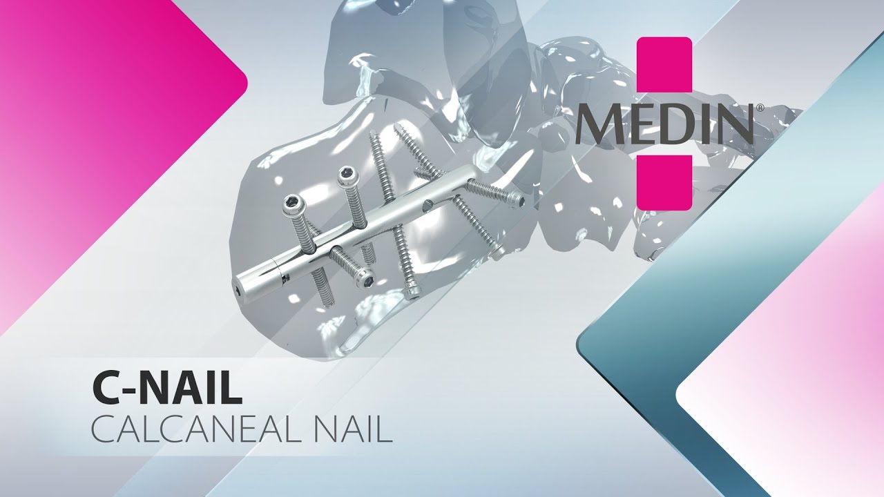 C-NAIL surgical technique (EN)