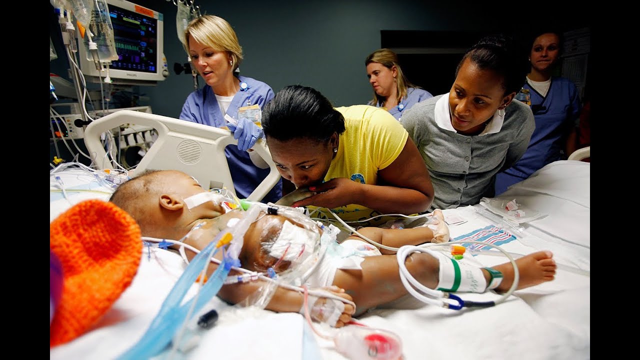 Conjoined Twins: Surgery