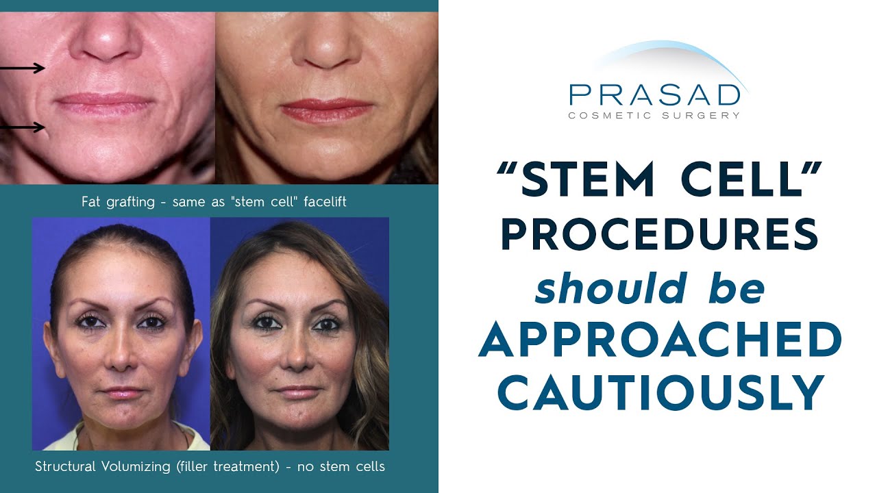 Factors to Consider in Stem Cell 