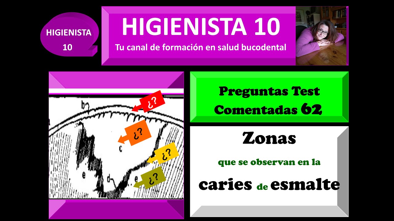 ZONAS que se observan en la CARIES de ESMALTE.  Preguntas Test Comentadas 62.