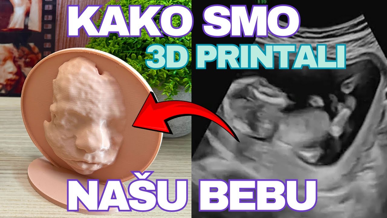 3D printanje fetusa (bebe) na temelju ultrazvuka