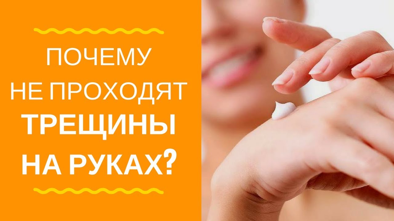 Трещины на руках и экзема! ✋ Почему не проходит?