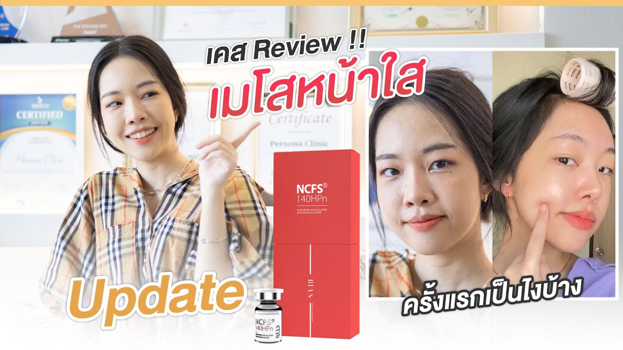 รีวิวเมโสหน้าใส !! พร้อมอัพเดทหลังทำ โปรแกรมหน้าใส Persona Clinic
