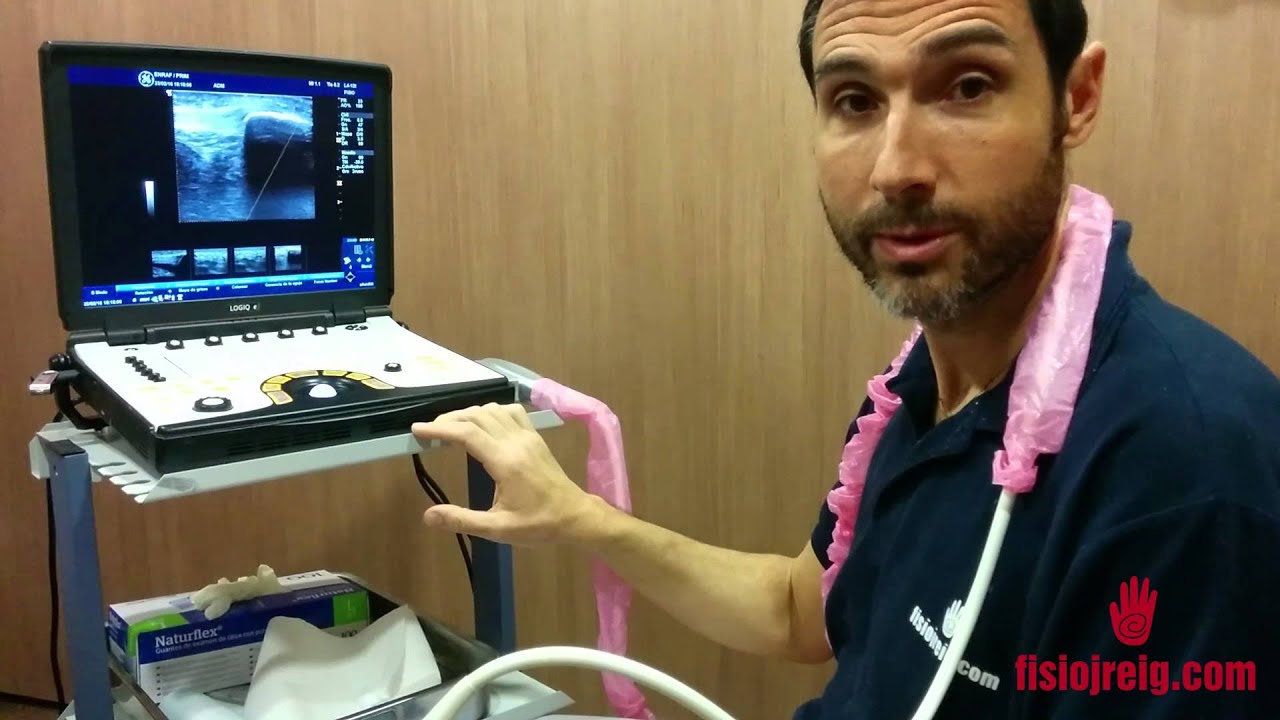 Ecografía músculo esquelética, test ecógrafo Logiq E-R7