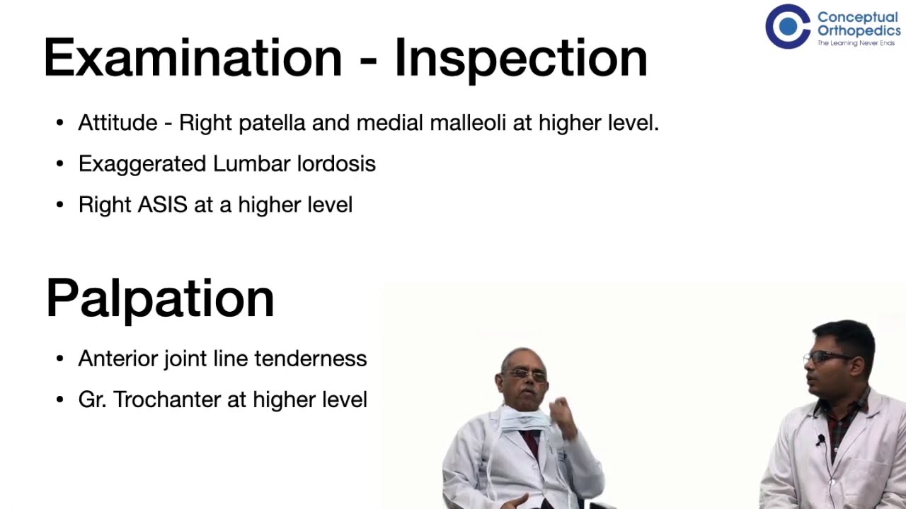 Q & A Session : TB Hip Case Discussion with Legendary Orthopedician Prof.Dr.Shantharam Shetty