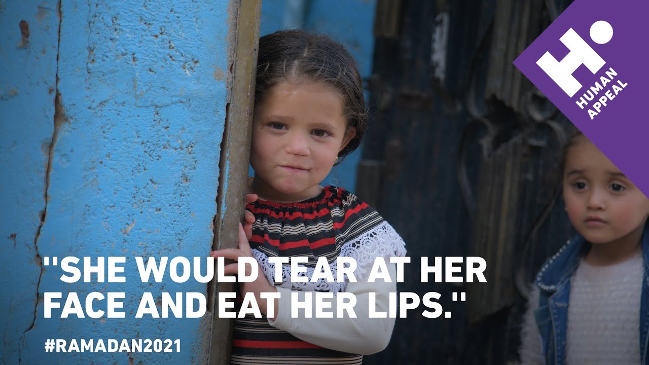 Little Hanaa was orphaned and malnourished