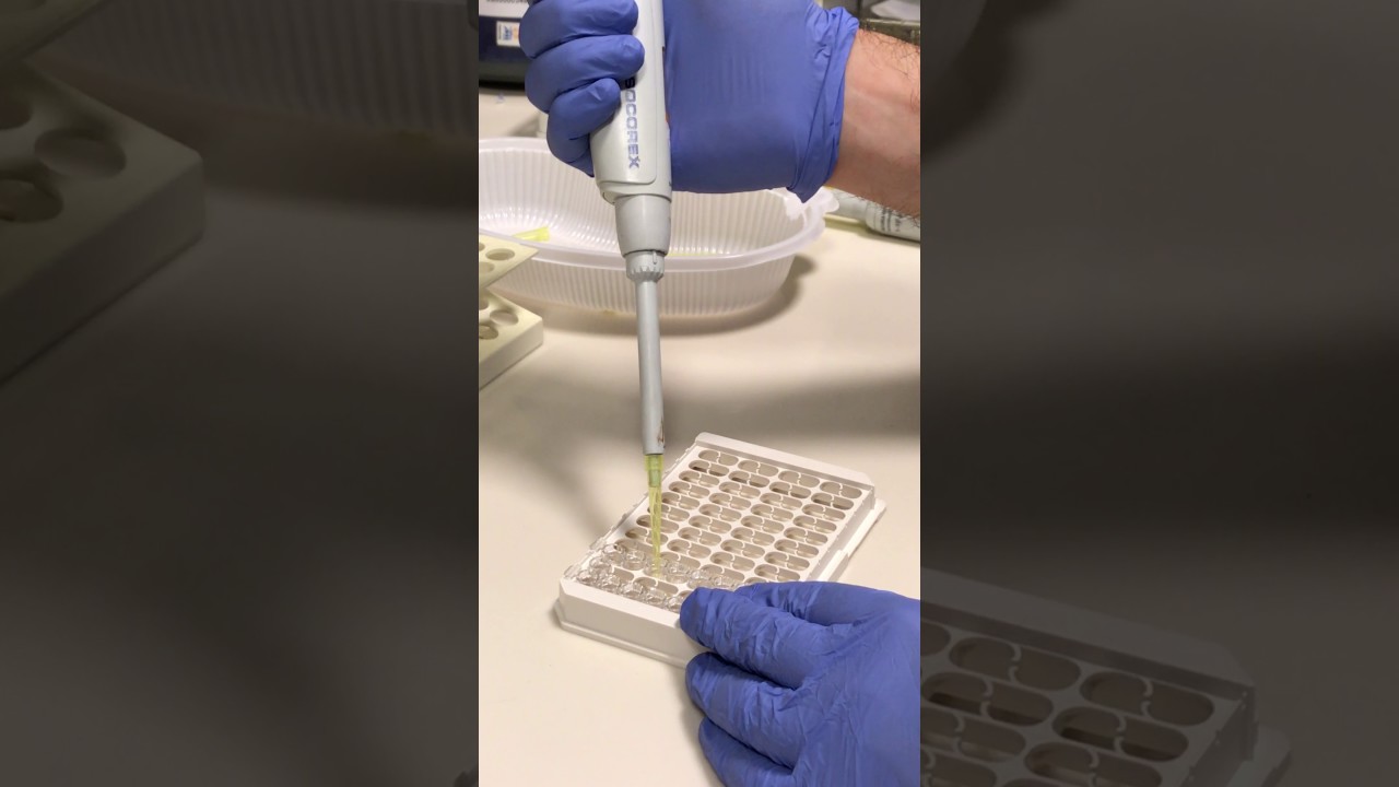 Brucella wright ( coombs ) testi yapılışı