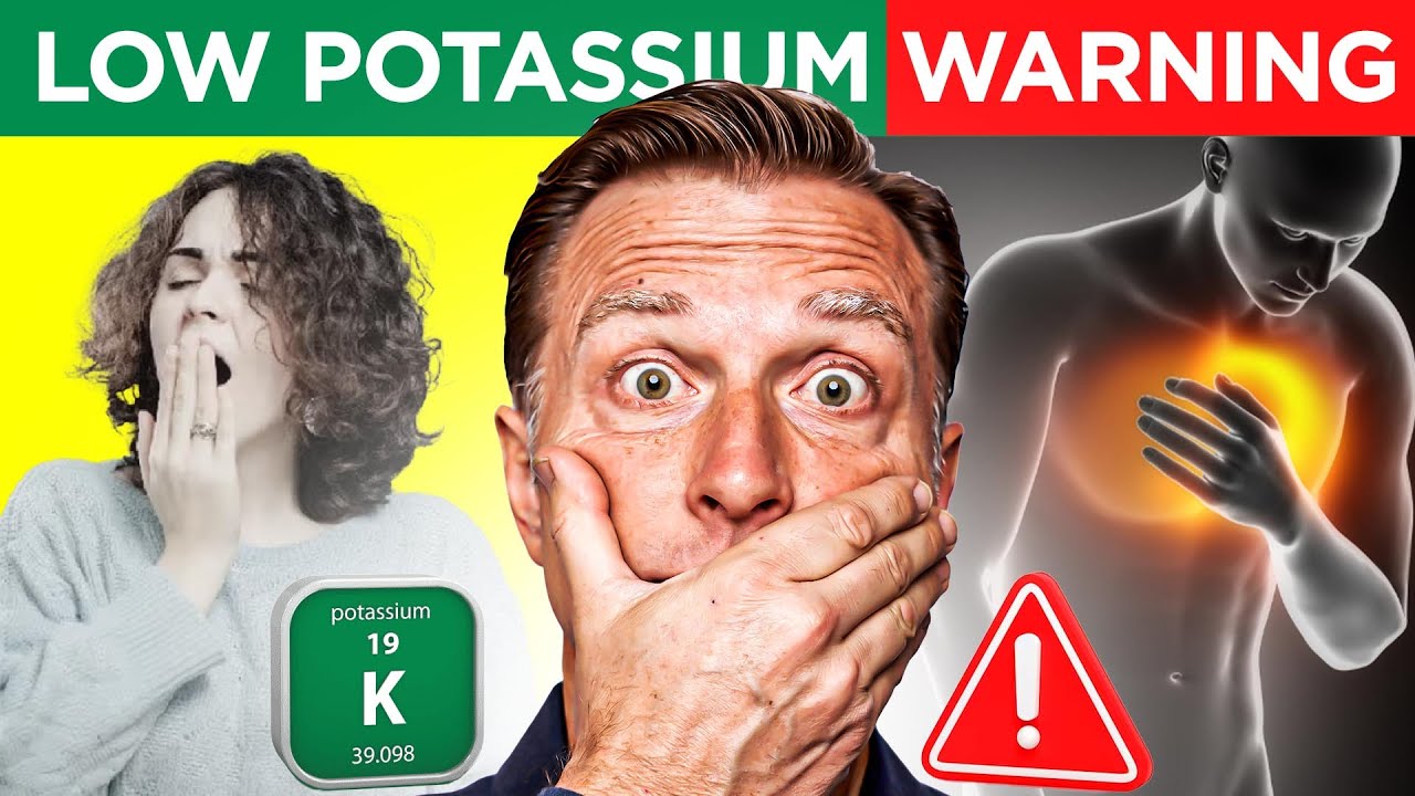 Epidemia niedoboru potasu: Dr Berg wyjaśnia objawy, oznaki, dietę, przyczyny i leczenie