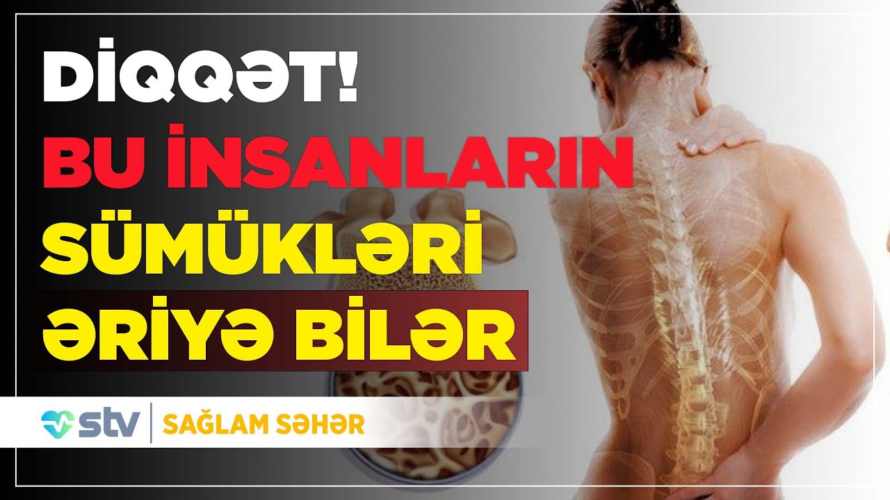 Sümük əriməsi - Qarşısını almaq istəyirsinizsə...