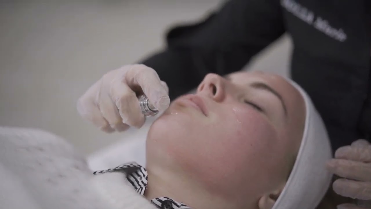 Utilisation de la technologie LaseMD Ultra par le docteur Alexandra Colombo à Metz