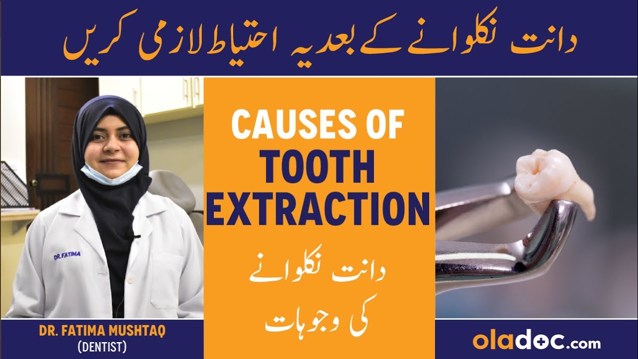 Tooth Extraction Aftercare - Dant Nikalwane Ke Wajoohat - Dant Nikalne Ke Baad Kya Karen