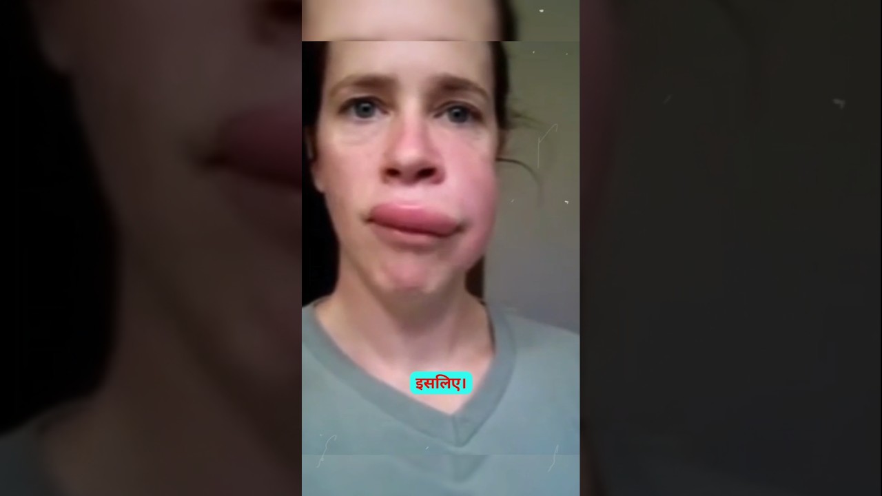 Honey Bees Attack 🐝🤯 #facts #shortvideo