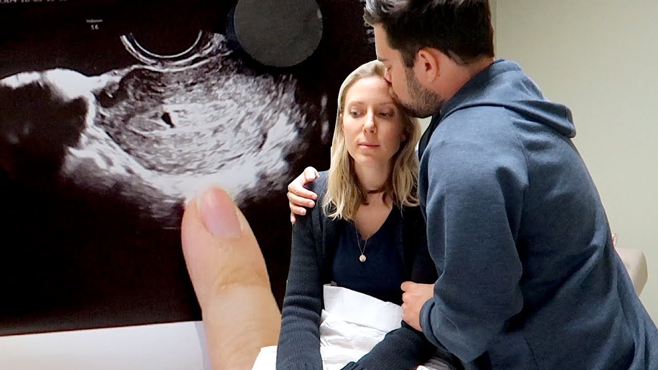 UNEXPECTED BAD NEWS AT SECOND ULTRASOUND