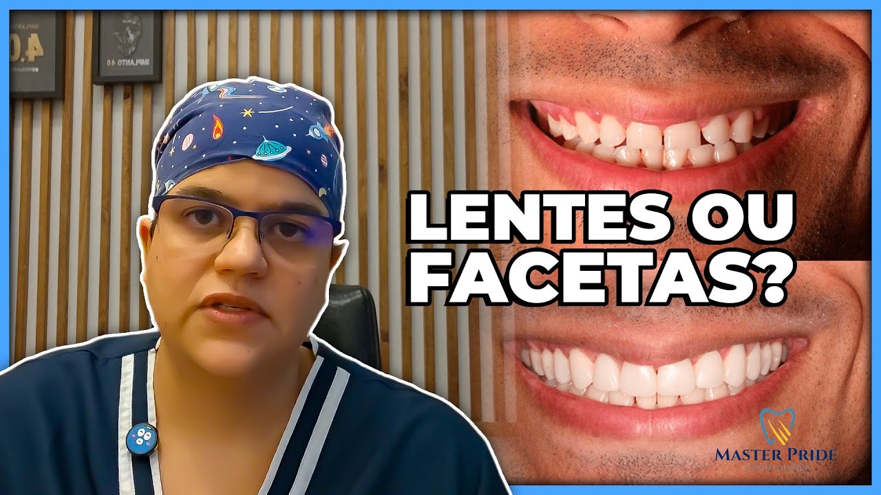 O segredo por tr&aacute;s das lentes e facetas dentais que ningu&eacute;m te conta| Master Pride Odontologia |