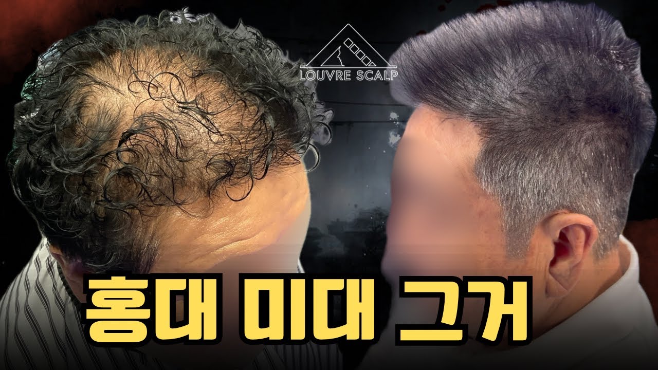홍대 미대 그거 보고 결정했습니다