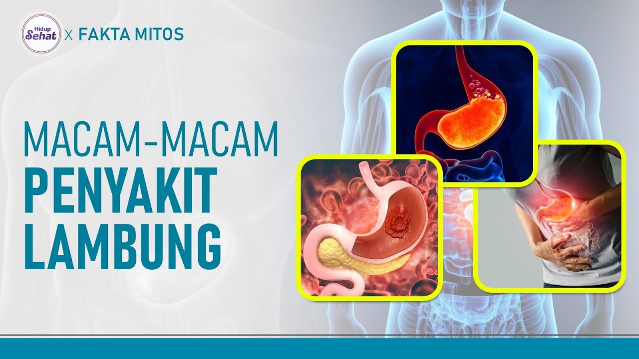Jangan Salah! Kenali Berbagai Penyakit Lambung dan Perbedaannya | Hidup Sehat tvOne