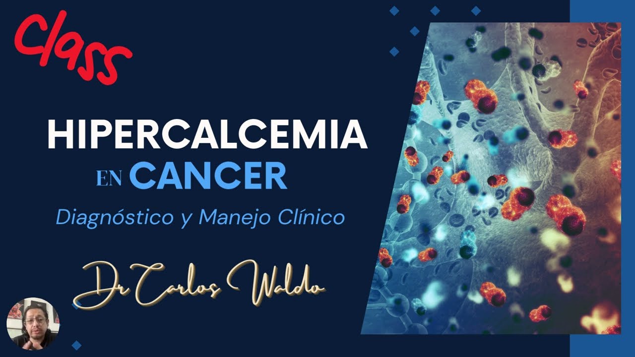 HIPERCALCEMIA EN CANCER  Diagnostico y manejo cínico
