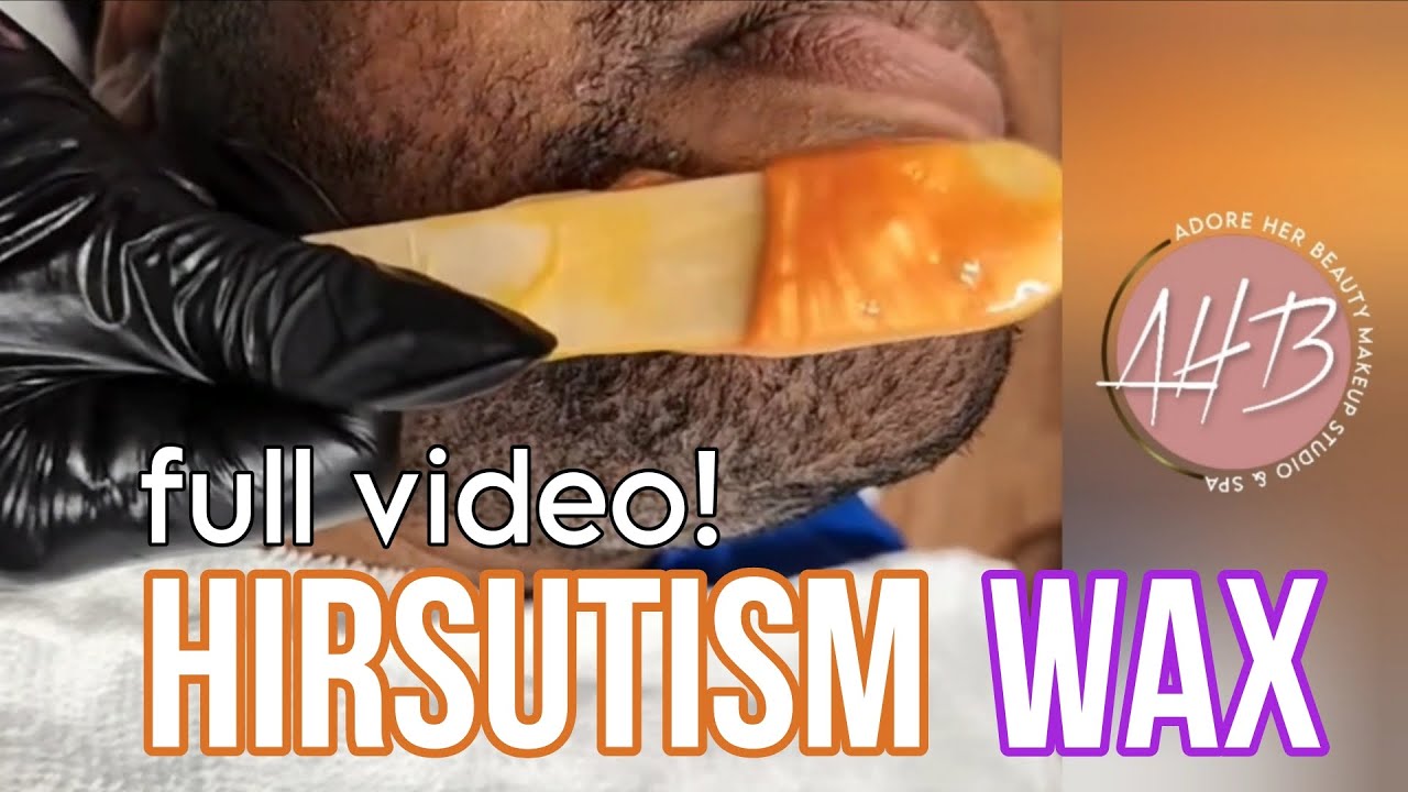 Hirsutism Wax | Full Process | From Live Session 