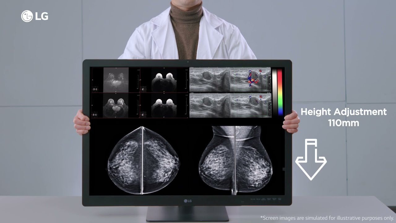 LG IT Medical Feature Overview Diagnostic Monitor 31HN713D