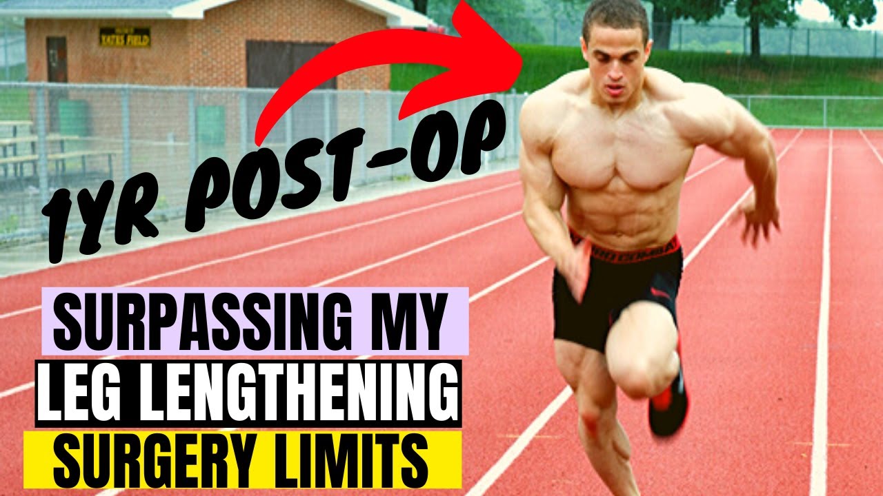 Squatting, Running, Agility, Jumping after Limb Lengthening Surgery