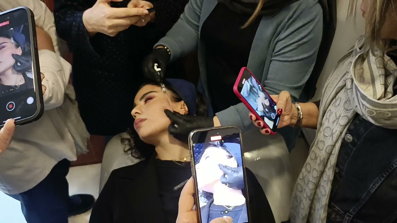 ورکشاپ نحوه ی تزریق محصول جدید پروفایلو استراکچورا  متخصصین پوست
