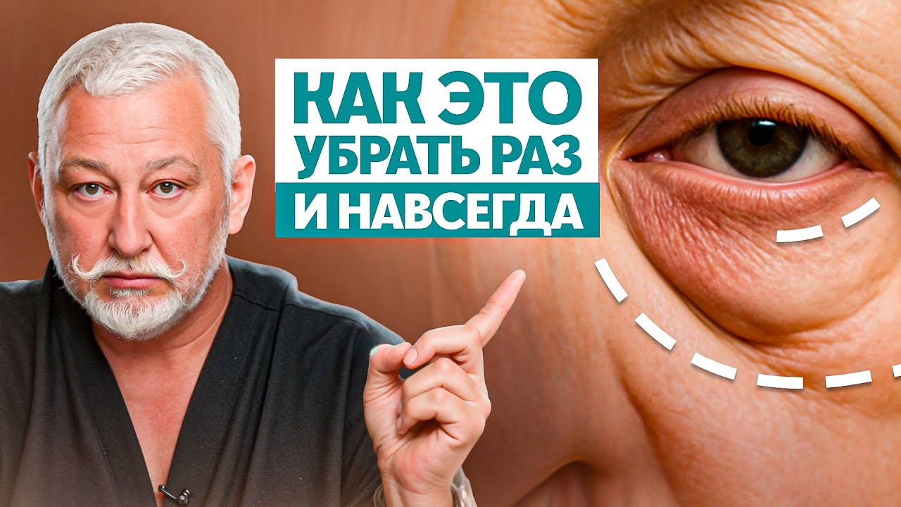 Отеки и мешки под глазами. Скрытые причины и 3 неожиданных решения