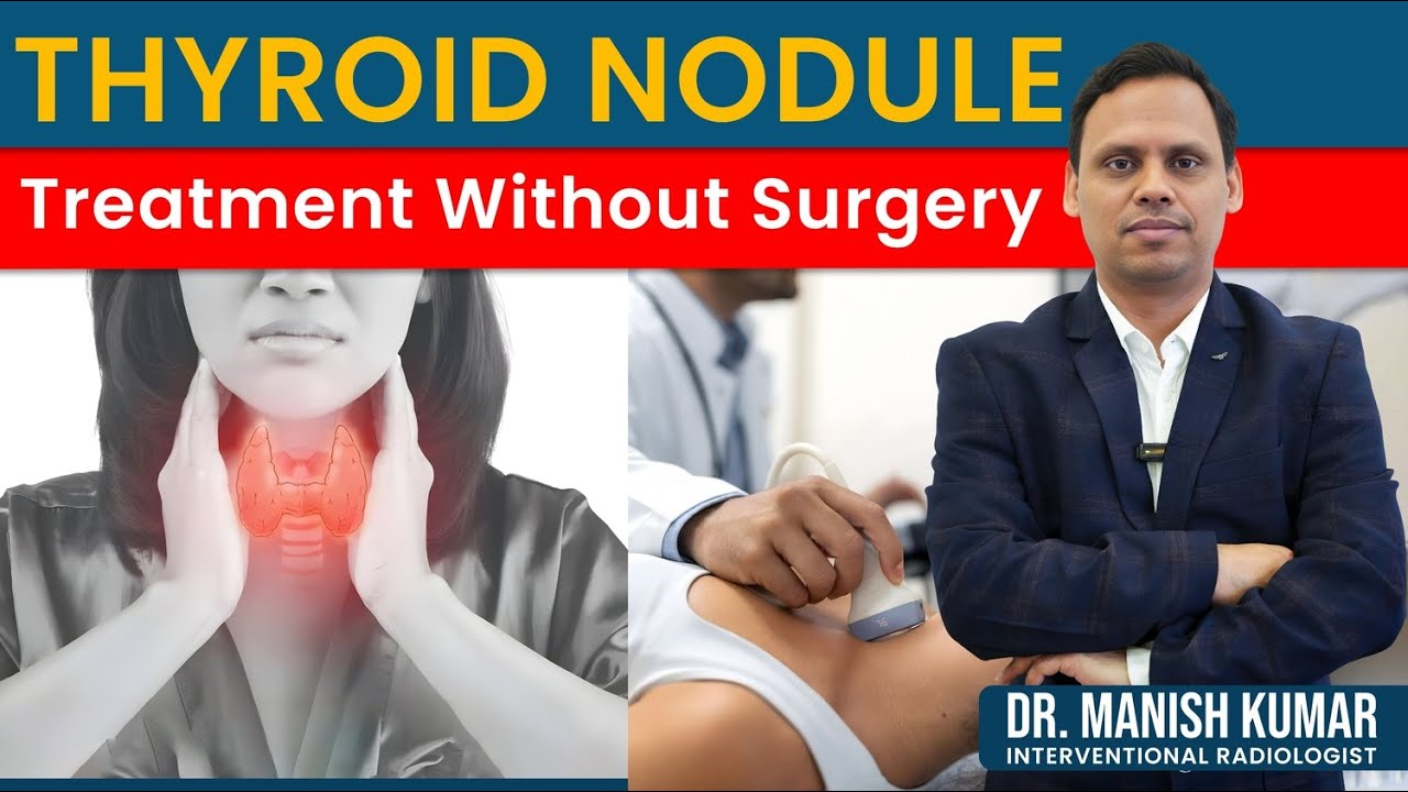 Thyroid Nodule : Treatment without Surgery | Dr Manish Kumar (IR)