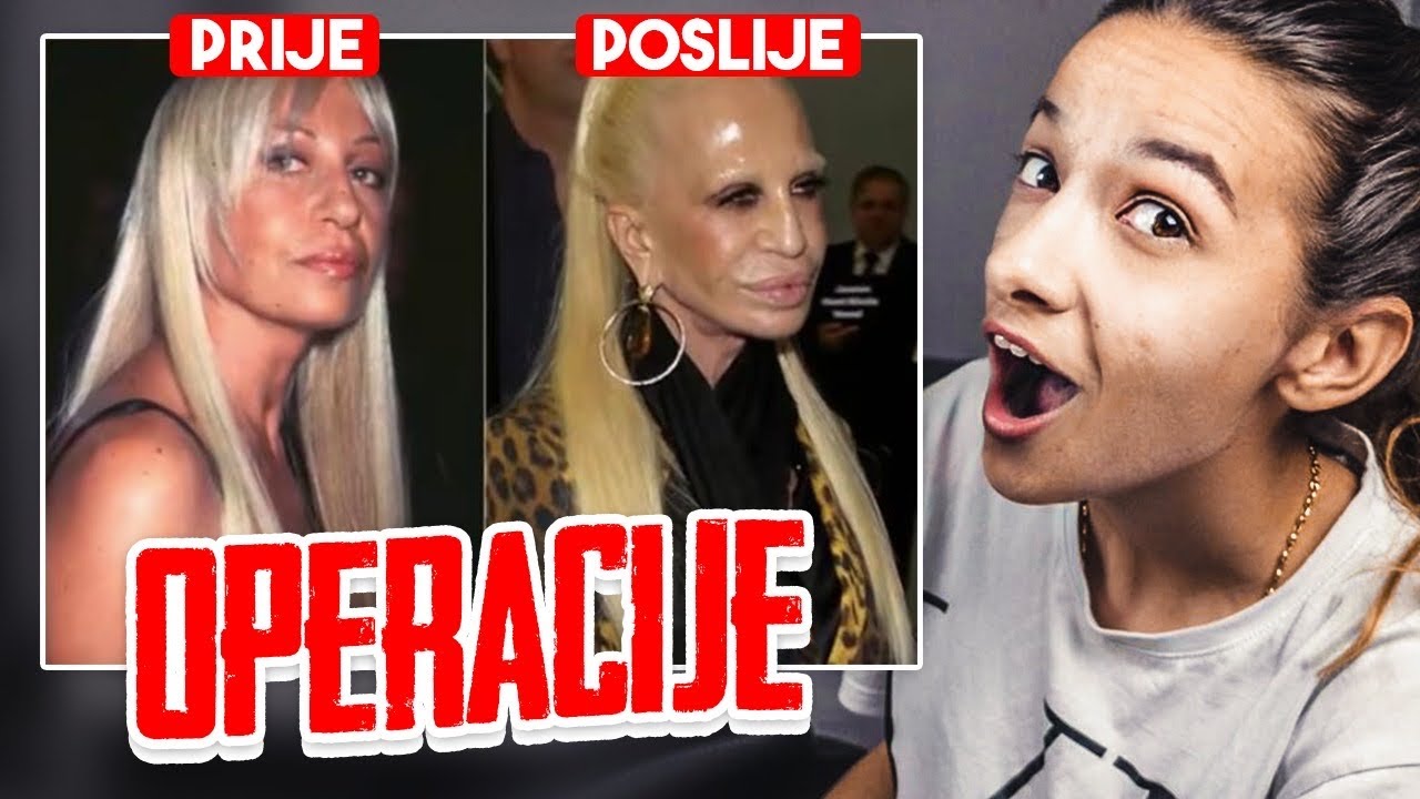 POZNATI PRIJE I POSLIJE PLASTIČNIH OPERACIJA 2