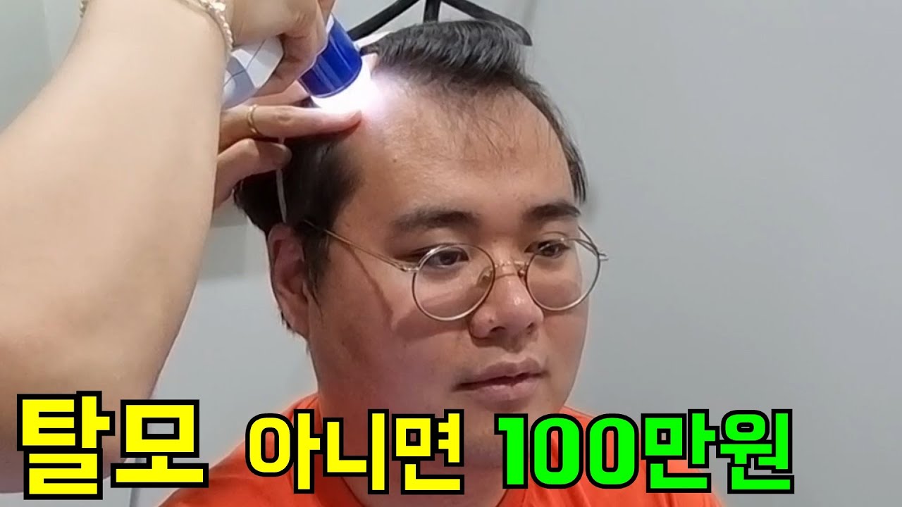 탈모 아니라고 우기는 형 100만원 내기 걸고 병원가기ㅋㅋㅋ